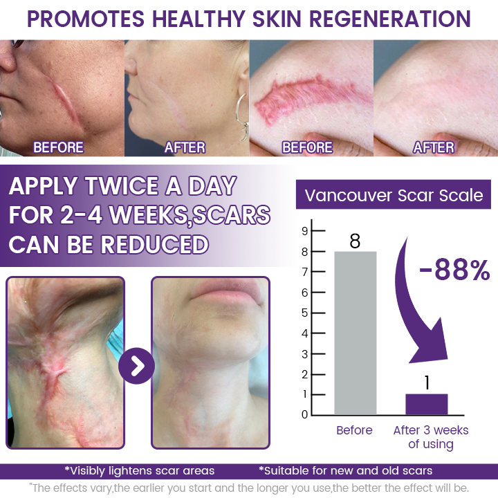 Timilk RegenScar Gel - how it works